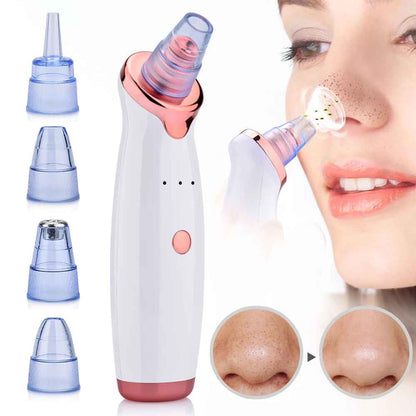 PoreVive – Aspiratore Professionale per Punti Neri