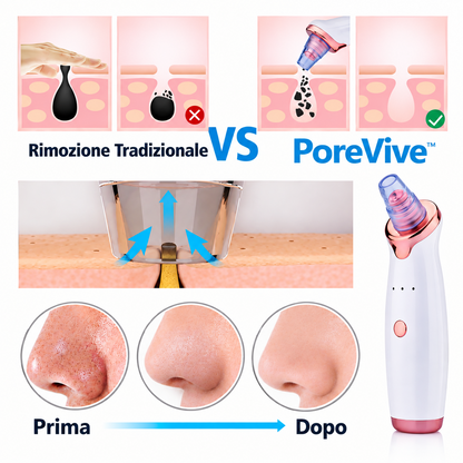 PoreVive – Aspiratore Professionale per Punti Neri