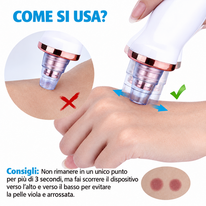 PoreVive – Aspiratore Professionale per Punti Neri